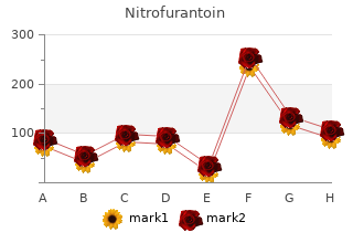 purchase 50 mg nitrofurantoin free shipping