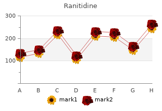 generic ranitidine 300mg with amex