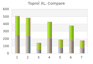 buy 50mg toprol xl mastercard