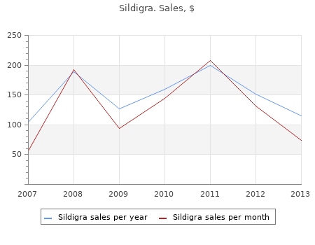 buy sildigra 120mg free shipping