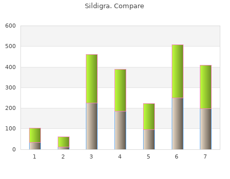 order sildigra 50 mg without a prescription