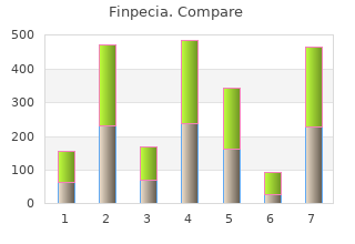 finpecia 1 mg overnight delivery