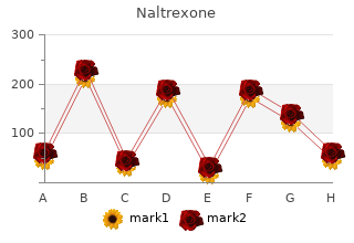 generic naltrexone 50 mg with amex