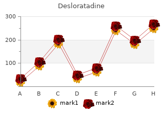 cheap 5mg desloratadine with mastercard