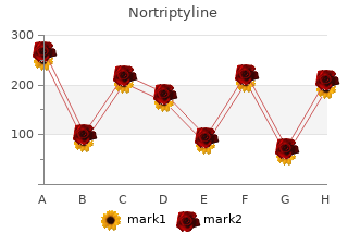 discount 25mg nortriptyline with amex