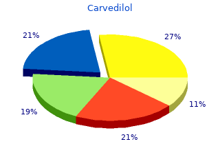 order carvedilol 12.5 mg mastercard