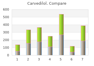 cheap carvedilol 25 mg free shipping