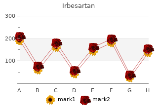 buy irbesartan 300mg amex