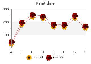 discount ranitidine 150mg free shipping