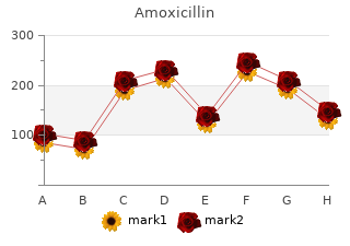 discount amoxicillin 250mg free shipping