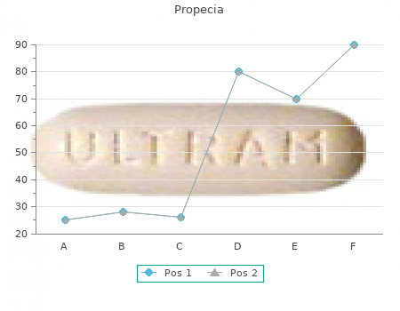 buy generic propecia 5mg on line